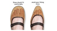 Pointed High Heels - The Sole Clinic