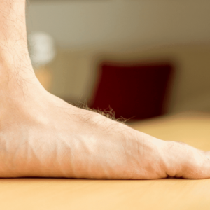Children & Adult Flat Feet podiatry treatment