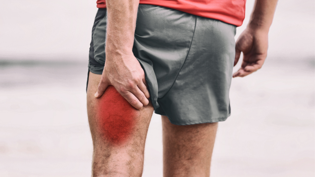 A runner gripping their hamstring in pain, indicating muscle strain or injury. Proper physiotherapy and rehabilitation can help prevent long-term damage and aid recovery.