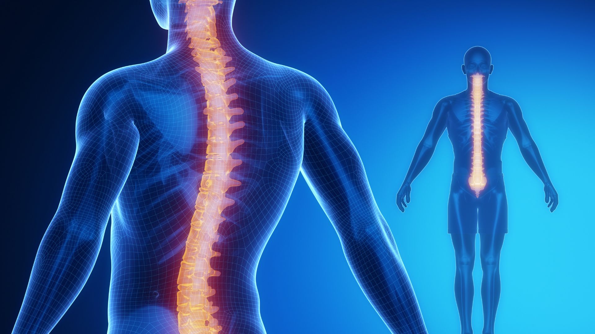 Can You Really ‘Exercise’ Your Spine Straight? Let’s Talk Schroth Therapy!