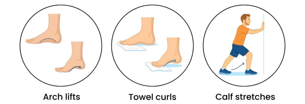 Illustration of flatfoot treatment exercises including arch lifts, towel curls, and calf stretches to strengthen foot muscles.