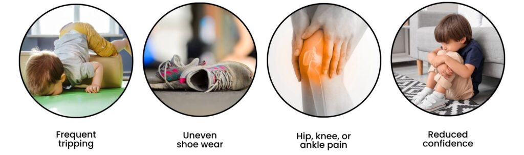 Infographic of types of problems that can be caused by pigeon toes