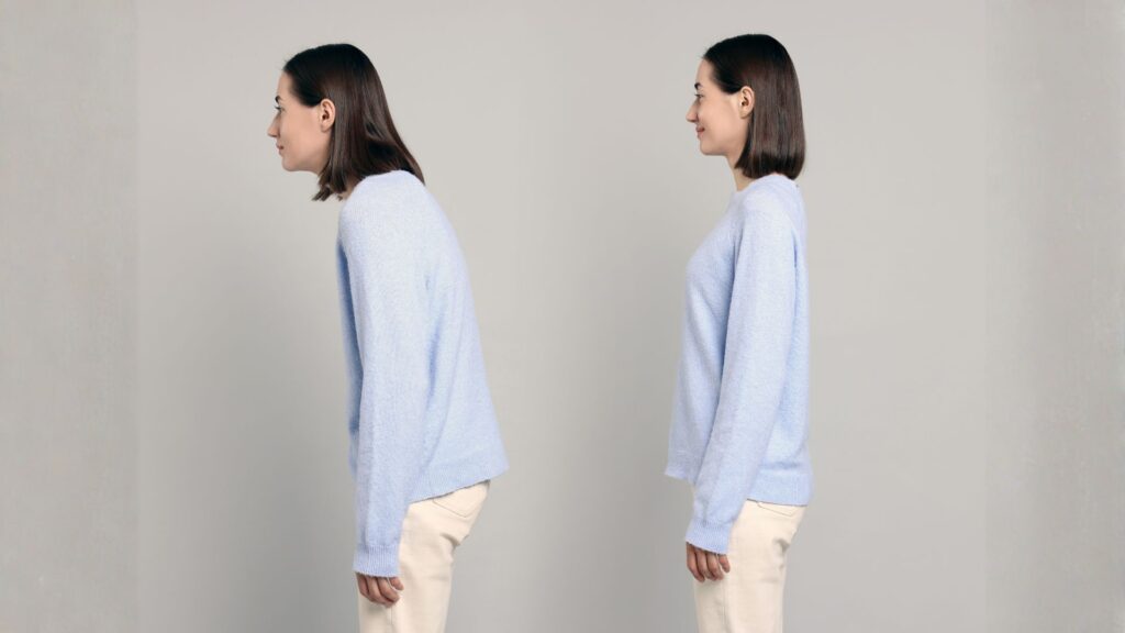 Postural and Alignment Check