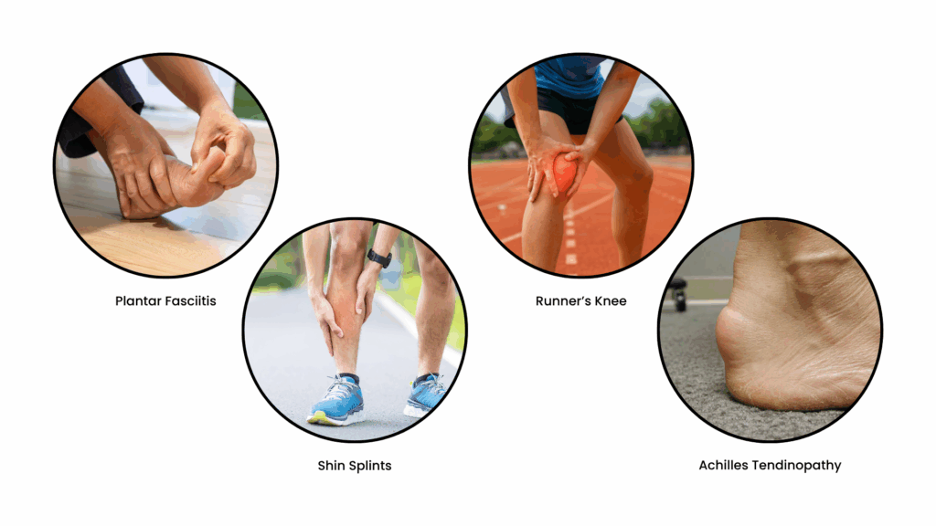 common running injuries, and how can a podiatrist help