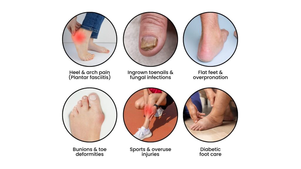Graphic showing heel pain, ingrown toenails, flat feet, bunions, sports injuries, and diabetic foot care managed by podiatrists.