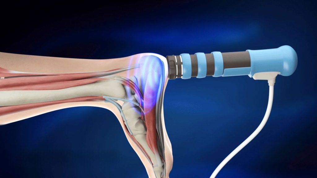 Illustration showing shockwave therapy delivering acoustic waves to tendon tissue to stimulate a healing response