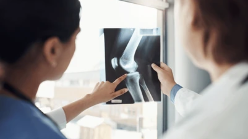 Clinician reviewing an elbow X-ray with a patient during an orthopaedic or physiotherapy consultation