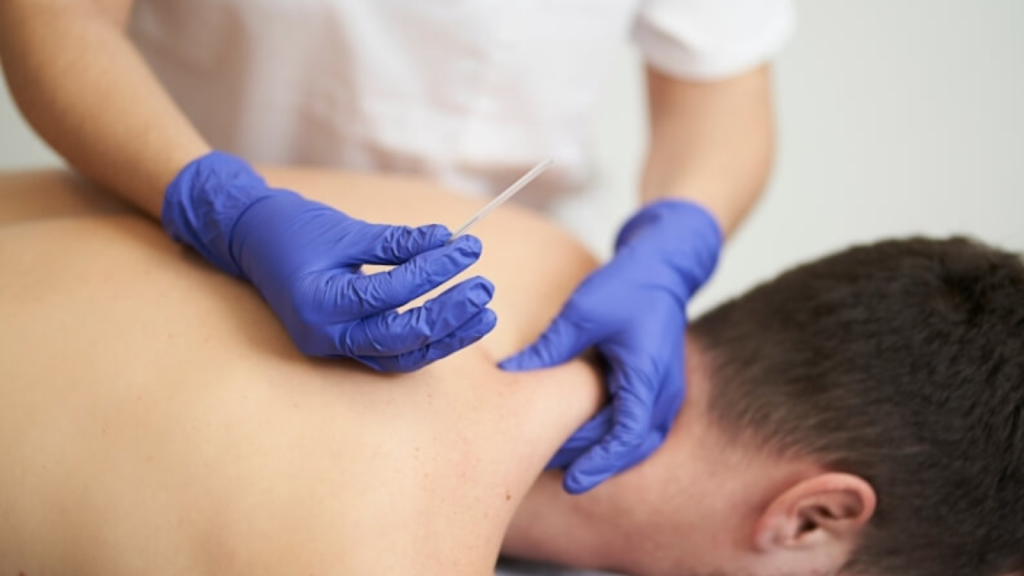Dry needling treatment for neck muscles used in physiotherapy for chronic tension headaches
