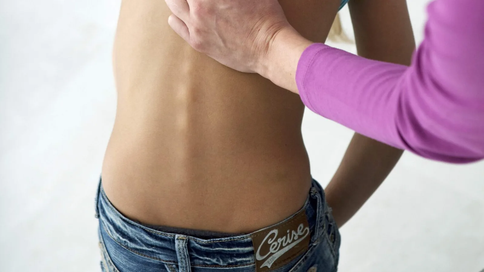 Physiotherapist assessing a patient with scoliosis 脊柱侧弯
