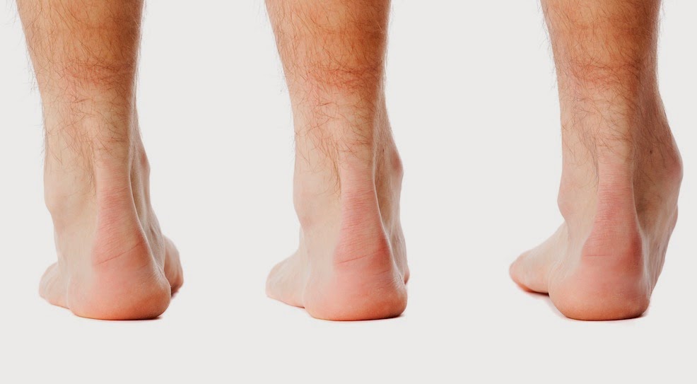 First Sports Podiatry Consultation - Standing Foot Posture Assessment - The Sole Clinic