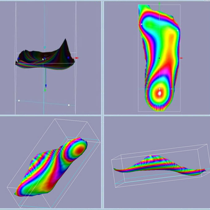 Custom Insoles - 3D Feet Scans - The Sole Clinic