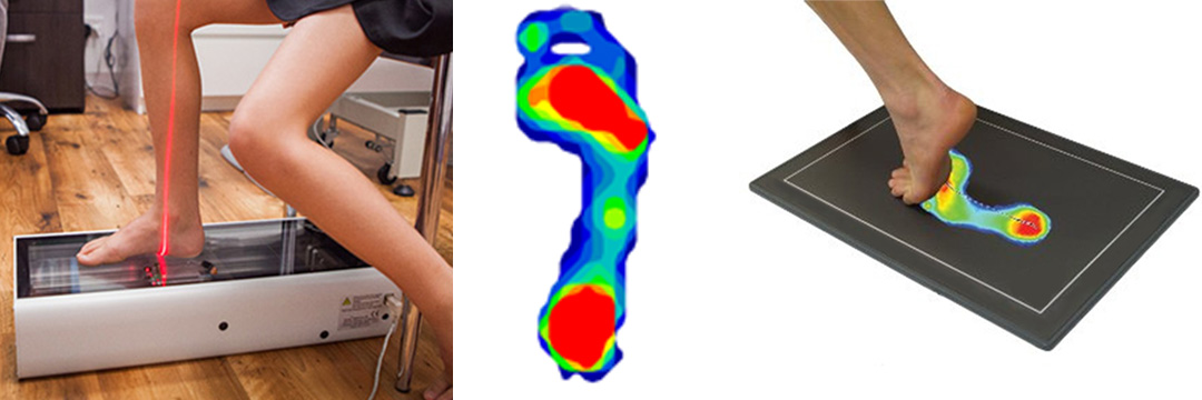 Custom Insoles Pressure Mat - The Sole Clinic