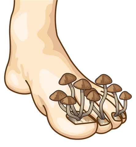PACT - Toenail Fungus