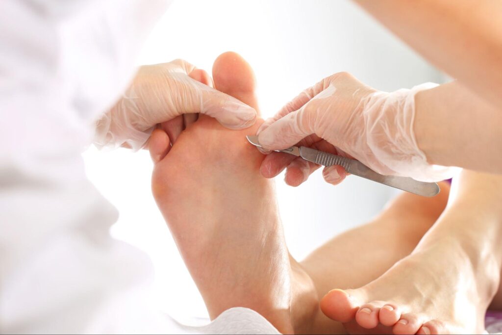 podiatrist using scalpel on patient's feet