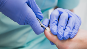 Ingrown toenail treatment