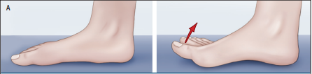 Cartoon feet showing short foot exercises