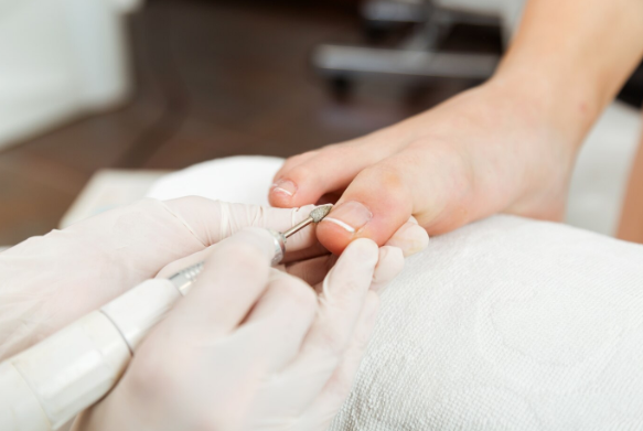 Close-up of a podiatrist performing a medical pedicure with precision tools in a sterile clinical setting, focusing on foot health and hygiene.