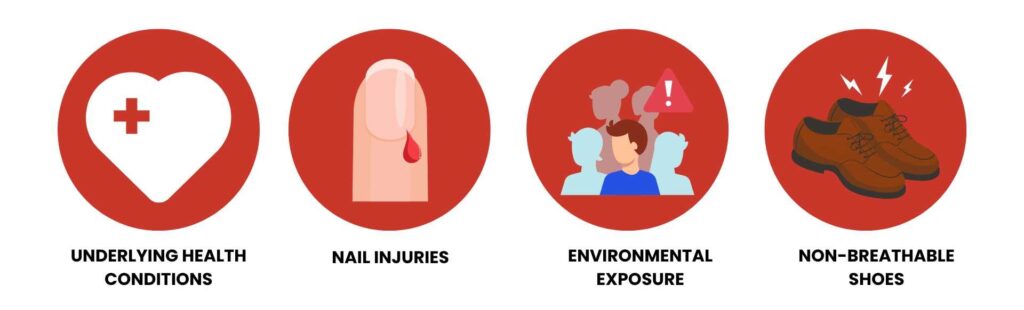 An infographic displaying four potential causes of nail issues or infections. Each cause is represented by a red circular icon with an illustration: (1) A heart with a medical cross symbol labeled 'Underlying Health Conditions,' (2) A bleeding fingernail labeled 'Nail Injuries,' (3) A group of people with a warning sign labeled 'Environmental Exposure,' and (4) A pair of brown shoes with lightning symbols labeled 'Non-Breathable Shoes.' Keywords: Nail Health, Fungal Nail Causes, Nail Injuries, Footwear Issues, Environmental Risk, Underlying Conditions.