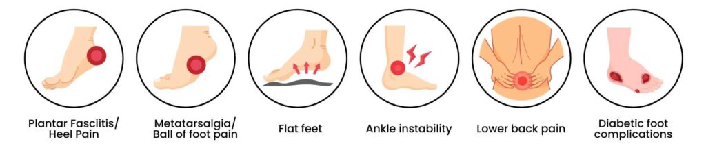  Illustration of heel and foot pain, numbness, balance issues, and diabetic wounds