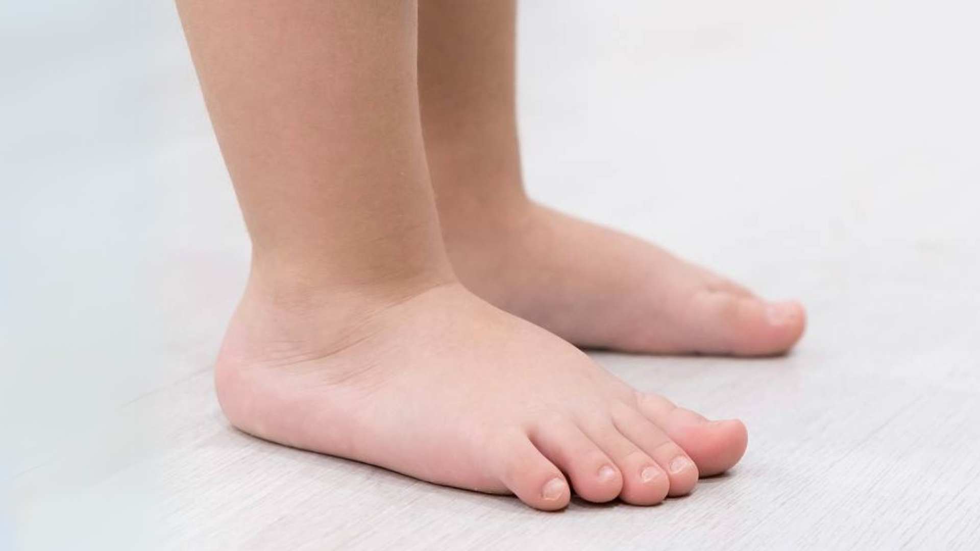 Close-up of child’s feet on a flat surface, highlighting arch and foot alignment.