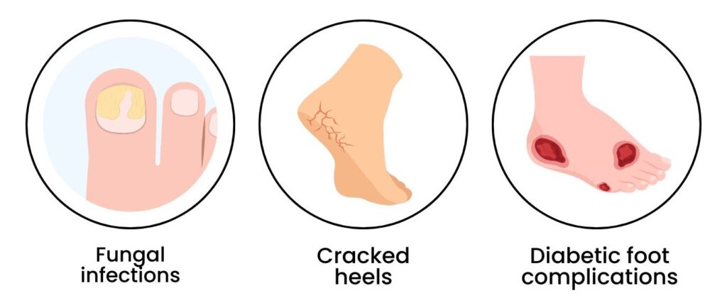 Infographic showing common foot conditions in seniors: fungal nails, cracked heels, diabetic ulcers