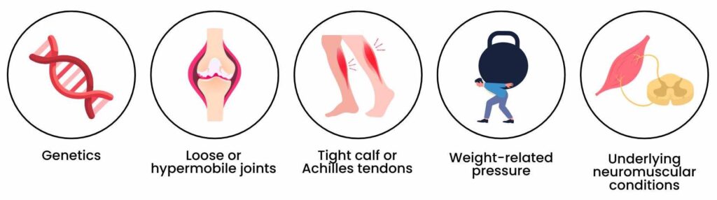 Illustration of causes of children’s flat feet, including genetics, joint