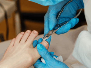 Medical Pedicure in Singapore