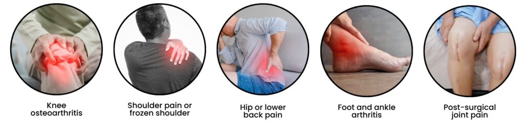 Infographic showing common joint conditions physiotherapy can help with, including knee osteoarthritis, frozen shoulder, and post-surgical pain.