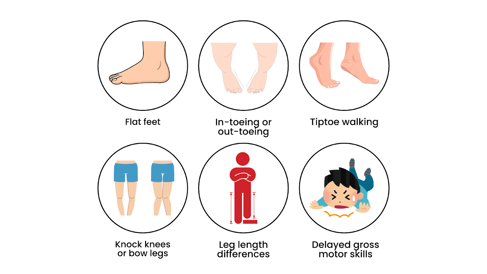 Illustrated icons showing common gait issues in children, such as flat feet, in-toeing, tiptoeing, and delayed motor skills.