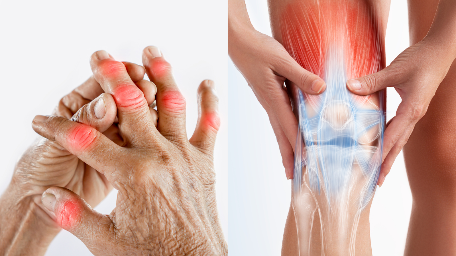 Close-up of hands and knee with arthritis inflammation, visualising areas targeted by physiotherapy.