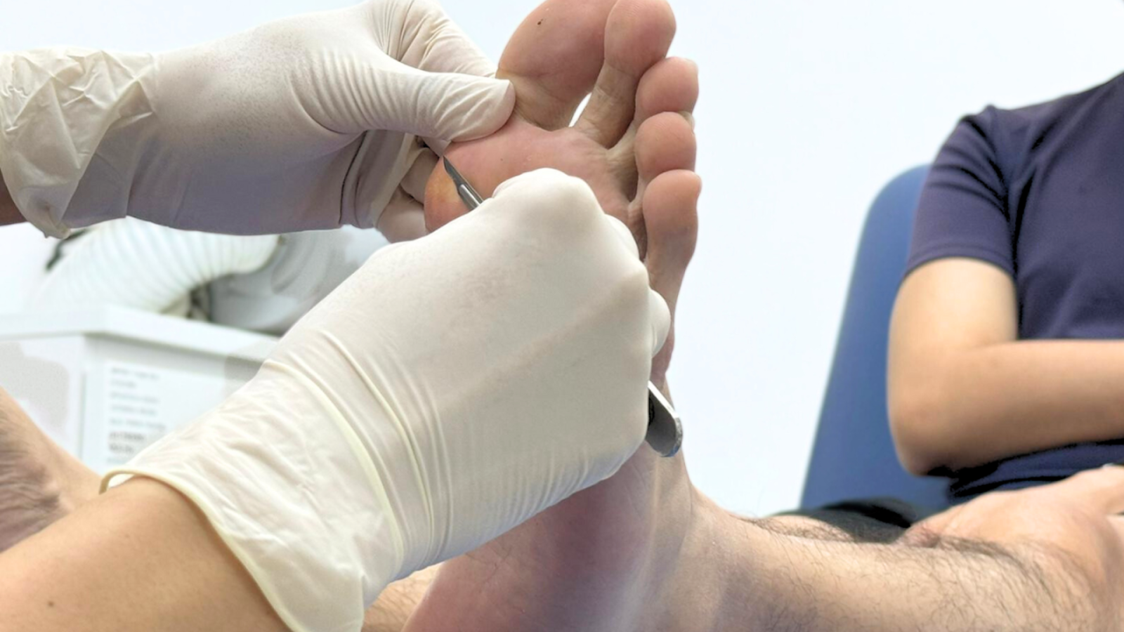 Foot treatment performed by podiatrist, showcasing professional care for peeling children's feet