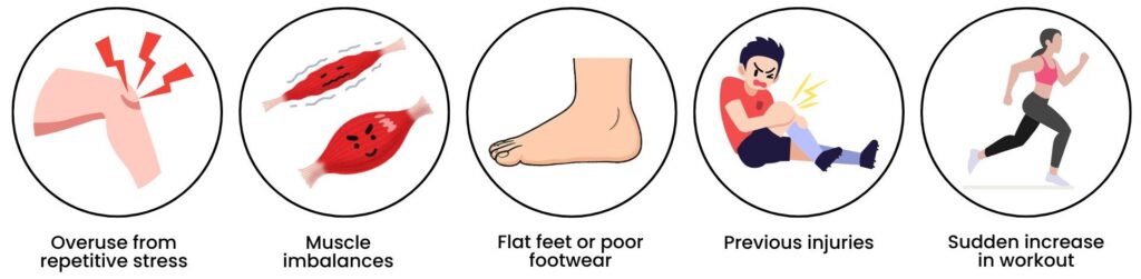 Common causes of patellofemoral pain syndrome illustrated with icons