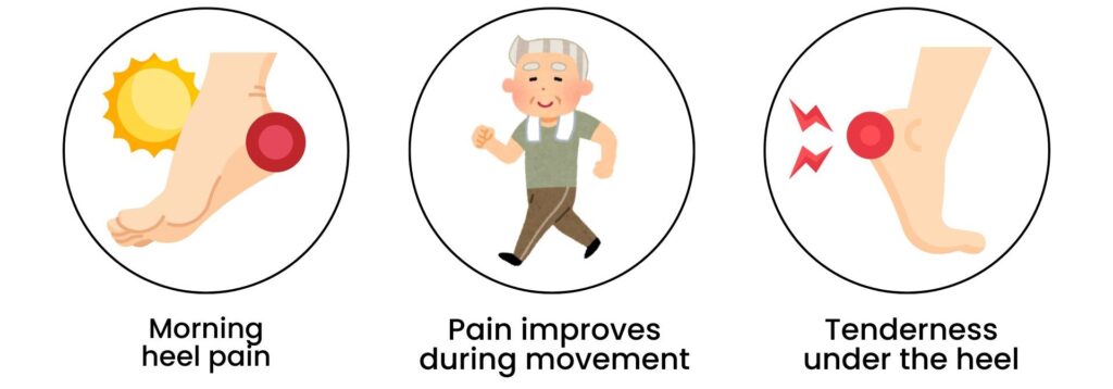 Key plantar fasciitis symptoms such as morning heel pain and tenderness