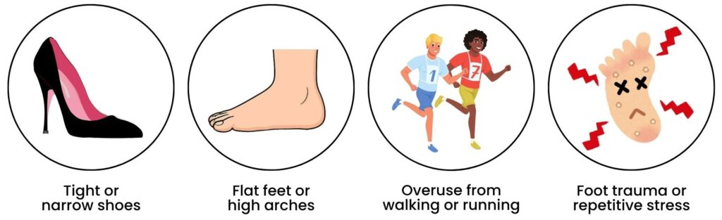 Common causes of Morton's Neuroma including tight shoes, flat feet, overuse from running, and repetitive stress.