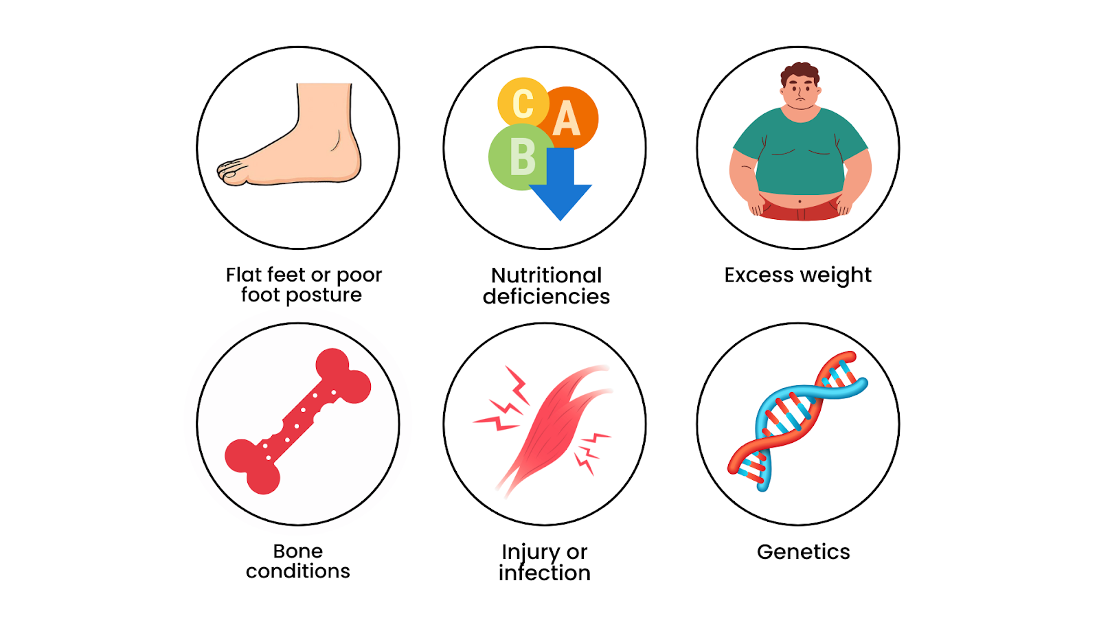 Visual icons showing common causes of knock knees in children, including flat feet, nutritional deficiencies, excess weight, bone conditions, injuries, and genetics.
