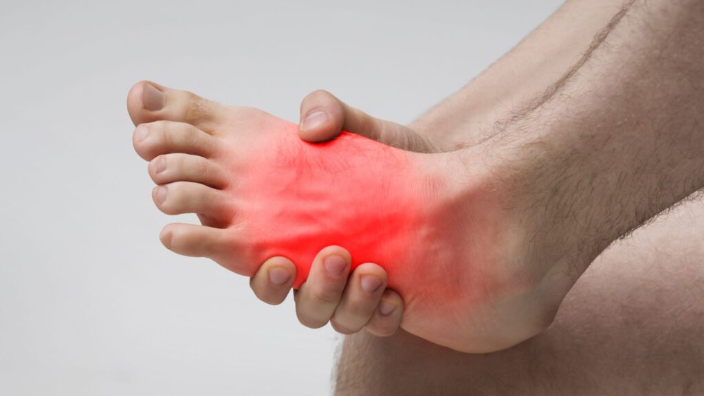 Close-up of intense midfoot pain, a common condition seen in Singapore.