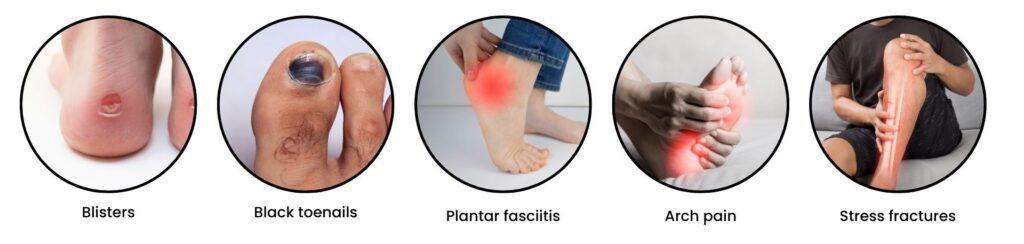 Infographic showing common foot injuries in marathon runners, including blisters, black toenails, plantar fasciitis, arch pain, and stress fractures — highlighting key marathon foot care issues in Singapore.