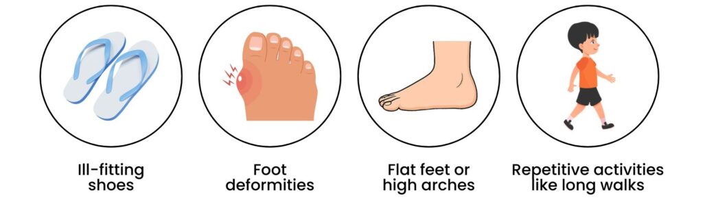 Causes of corns explained by podiatrists in Singapore: ill-fitting shoes, foot deformities, flat feet, and repetitive activities.