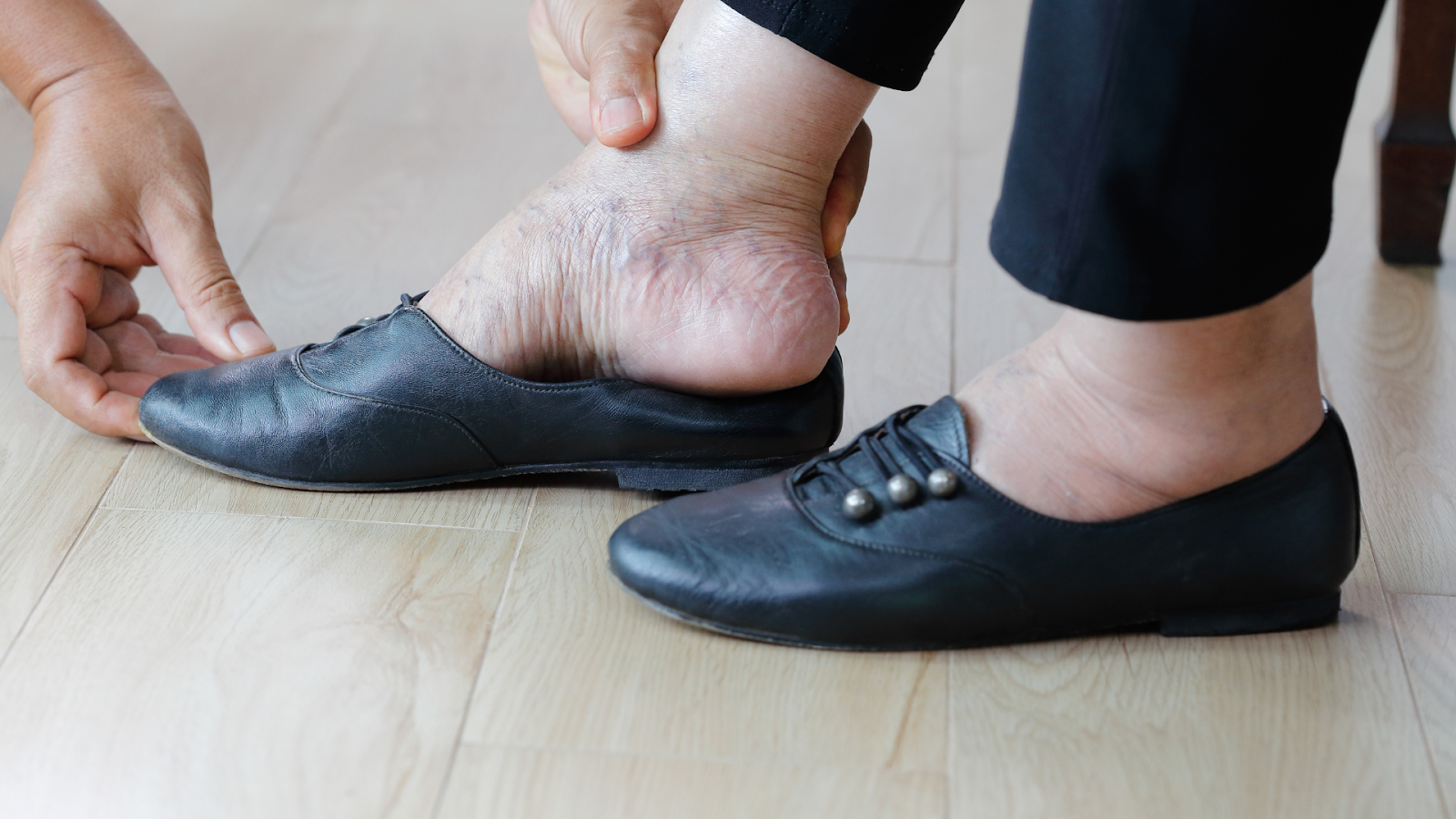 Podiatrist examining foot pain caused by rheumatoid arthritis