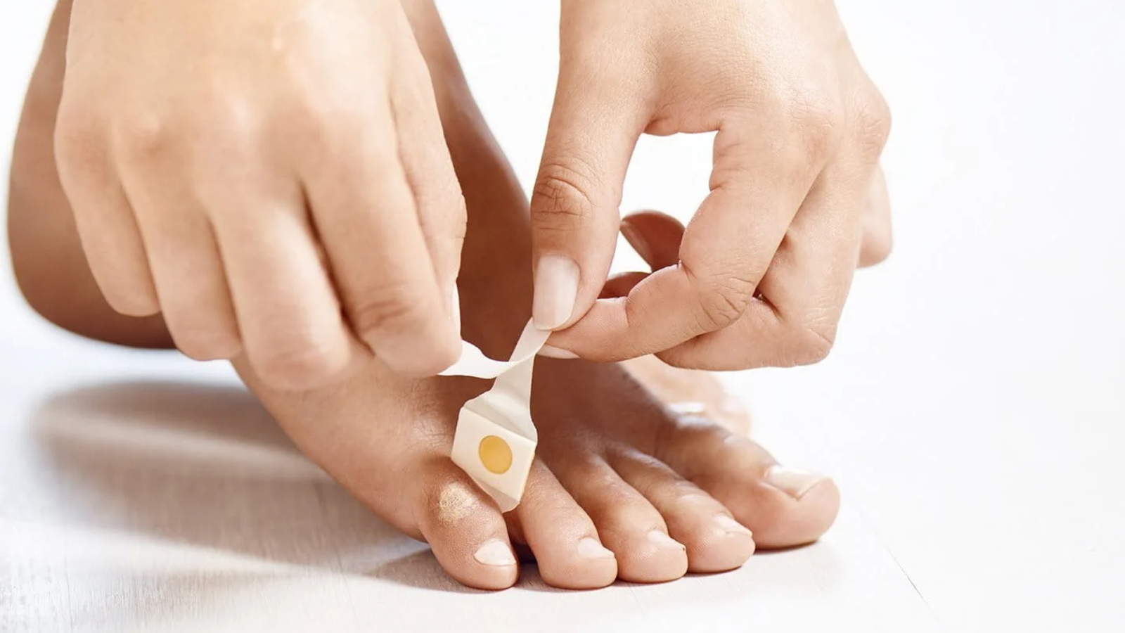 Applying corn plaster at home, a common DIY attempt before proper corn removal treatment in Singapore.