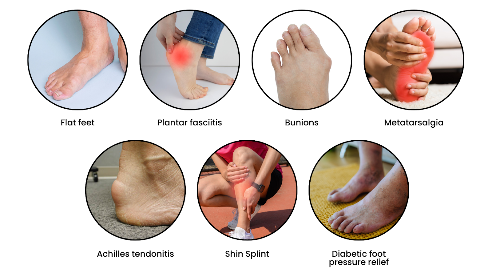 Collage of common foot problems including flat feet, plantar fasciitis, bunions, metatarsalgia, Achilles tendonitis, shin splints, and diabetic foot pressure relief.