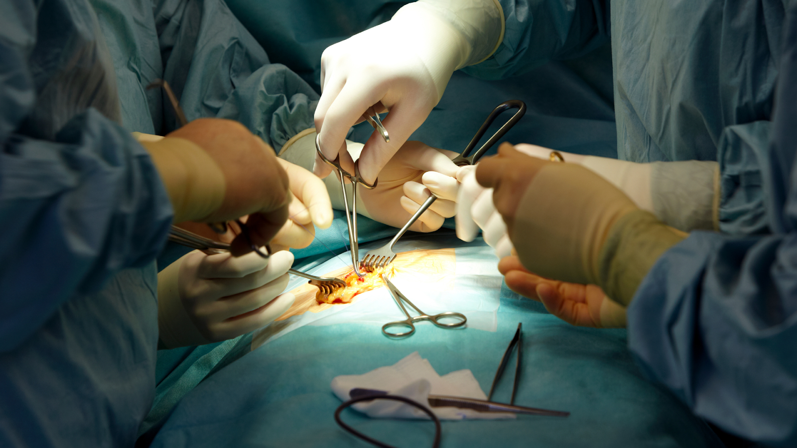 Surgeons performing an operation in an operating room, the first step before rehab post-surgery.