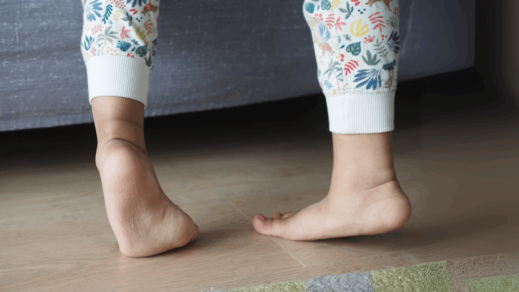 Child’s bare feet pointing inwards on wooden floor, typical sign of pigeon toe