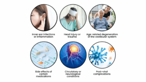 Causes of Vestibular Disorders