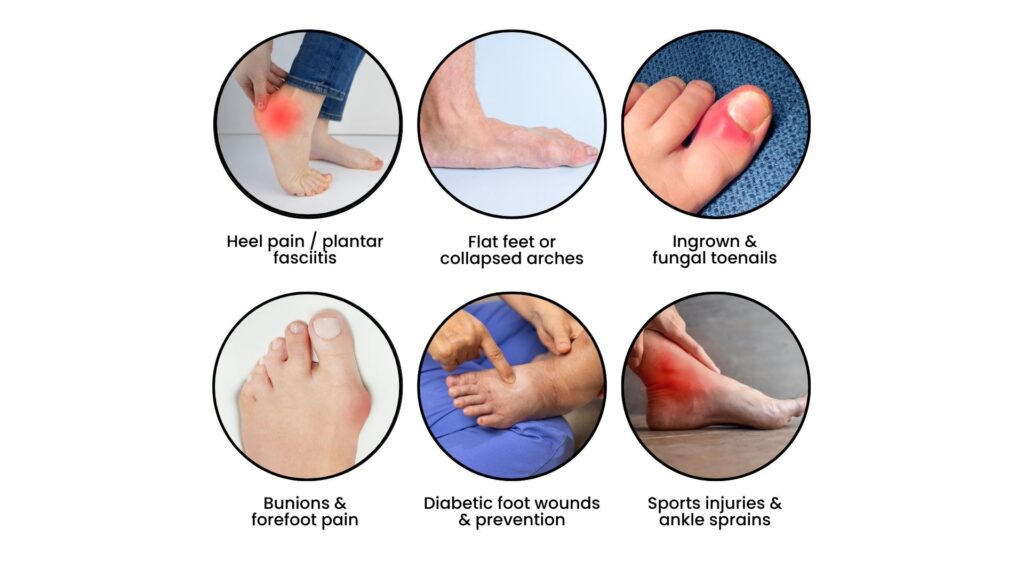 Illustrated chart showing common foot and ankle conditions managed by podiatrists, including heel pain, bunions, ingrown nails, and diabetic foot care.