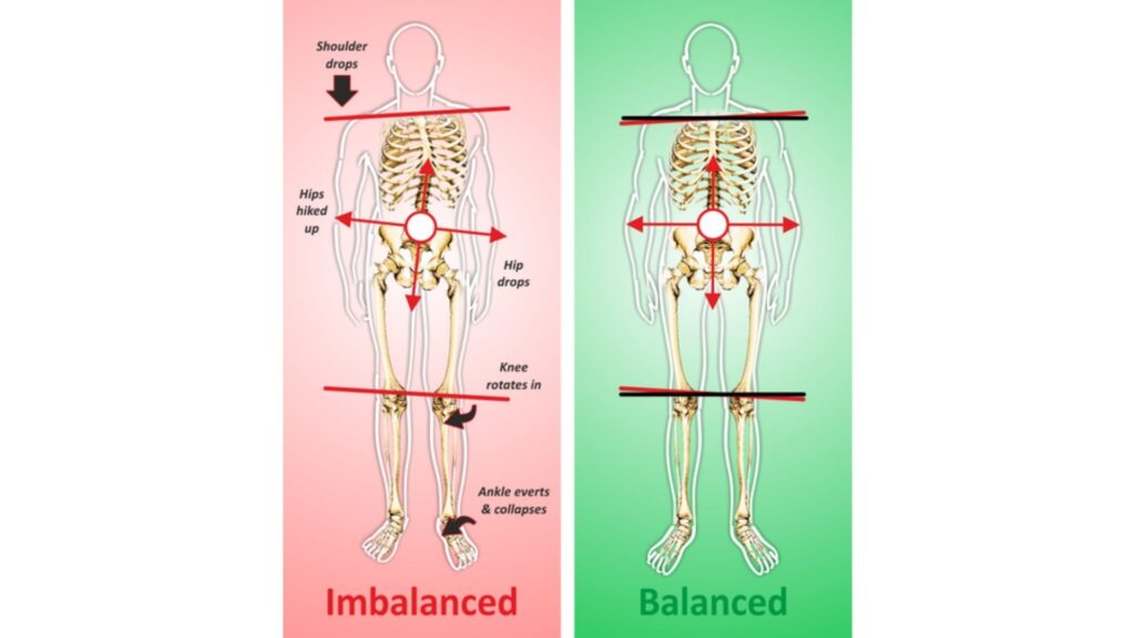 Diagram comparing imbalanced posture versus balanced alignment achieved with proper orthotic support