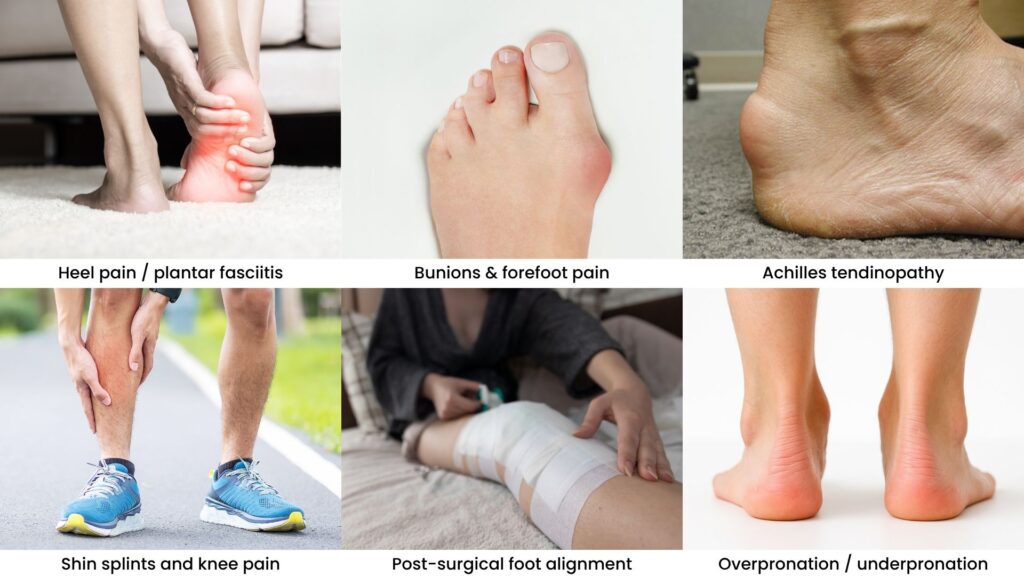 Infographic showing heel pain, bunions, Achilles tendinopathy, shin splints, and overpronation that benefit from orthotic treatment