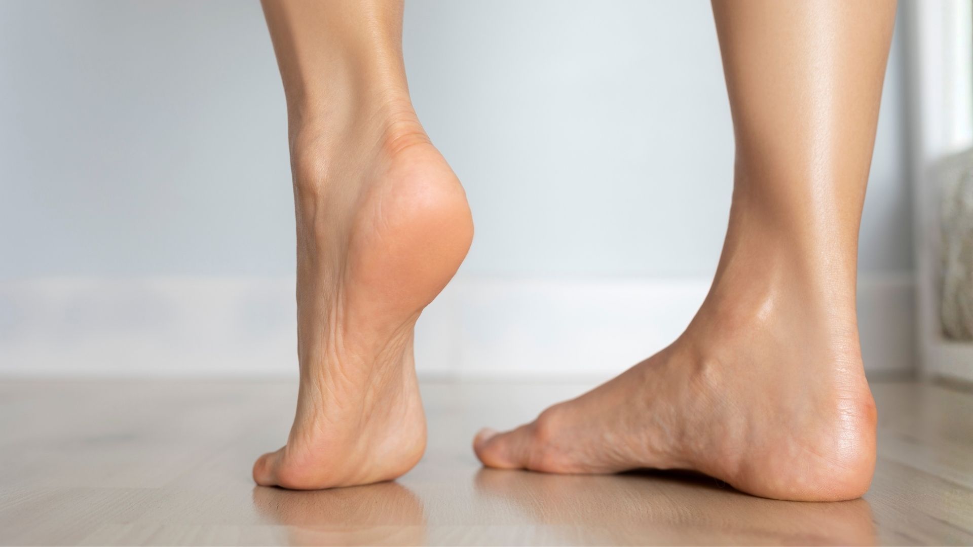 Close-up side profile of a foot with a noticeably high arch, demonstrating the steep arch shape seen in pes cavus.