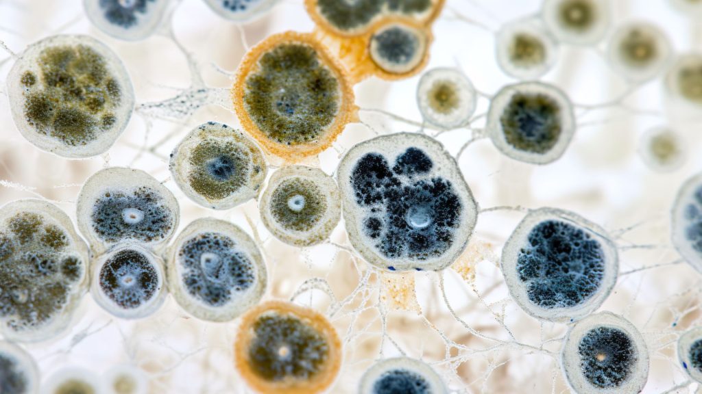 Microscopic view of fungi that commonly cause fungal nail infections