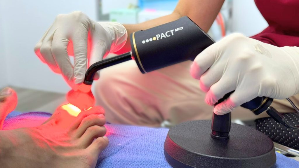 Podiatrist performing photodynamic light therapy treatment for fungal toenail infection